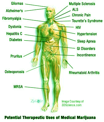 Medical Marijuana Conditions